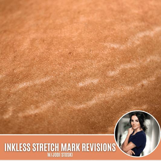 INKLESS STRETCH MARK REVISION